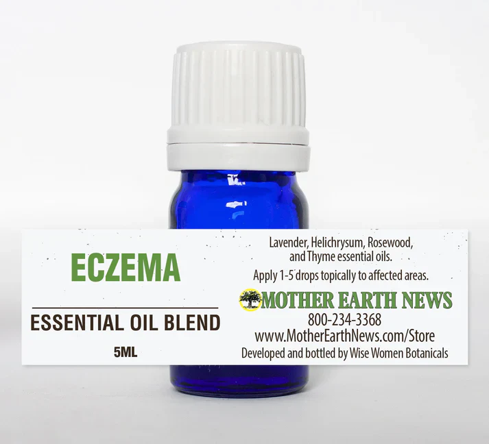 Eczema Essential Oil Blend - Image 2